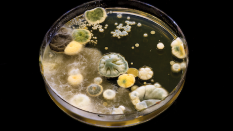 natural remedies for mould exposure